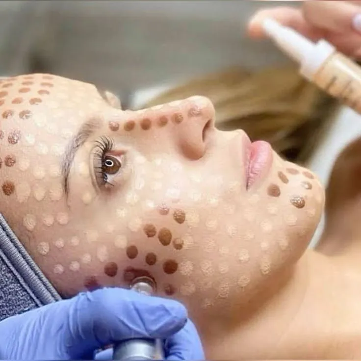 BB Glow (Face & Lips) at Kandyan Aesthetics in Kandy and Kadawatha, Sri Lanka