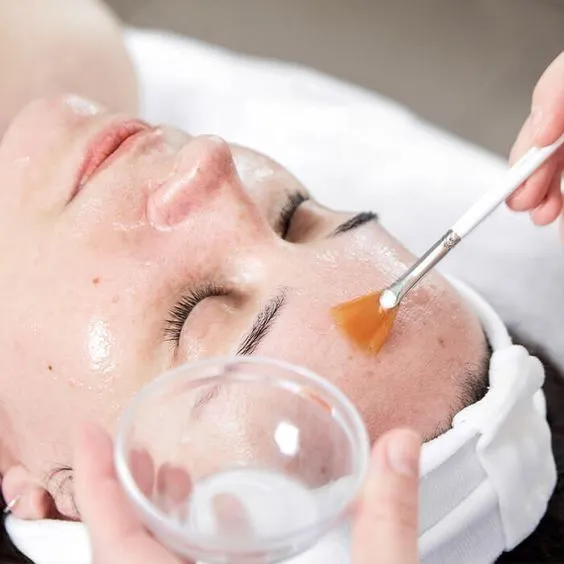 Chemical Peel (Face & Neck) at Kandyan Aesthetics in Kandy and Kadawatha, Sri Lanka
