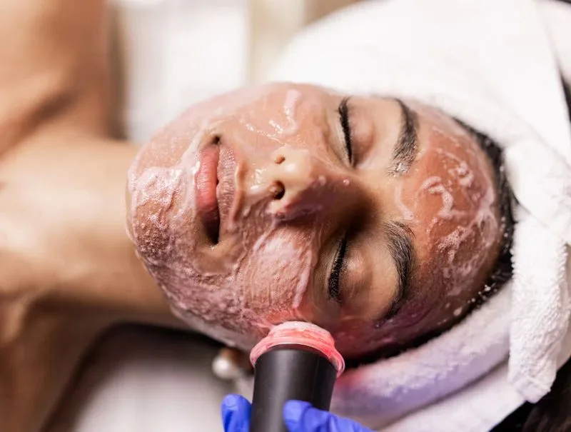 Oxygen Facial at Kandyan Aesthetics in Kandy and Kadawatha, Sri Lanka