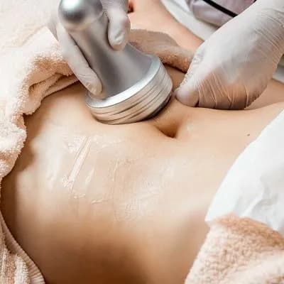 Non-surgical body contouring and fat reduction at Kandyan Aesthetics in Kandy and Kadawatha, Sri Lanka
