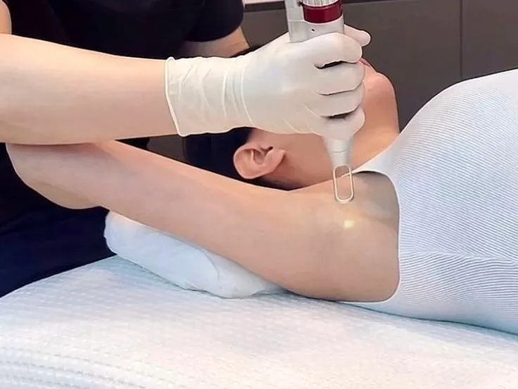 Carbon Treatment for Underarm Darkness at Kandyan Aesthetics in Kandy and Kadawatha, Sri Lanka